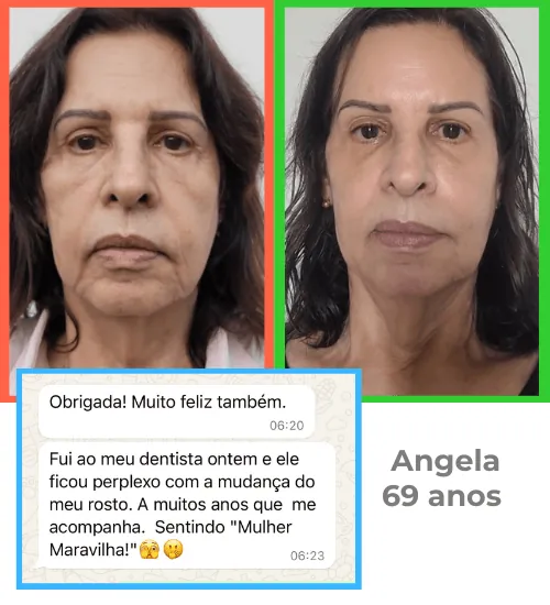 Resultado da Angélica