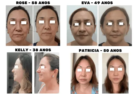 Garantia e depoimentos