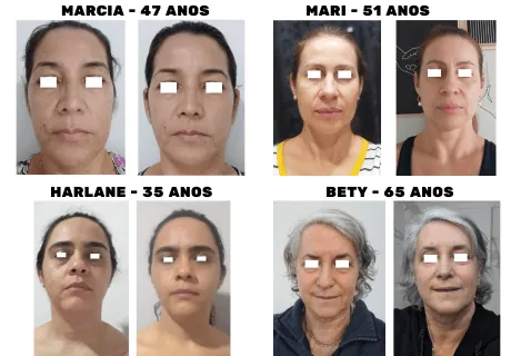Garantia e depoimentos
